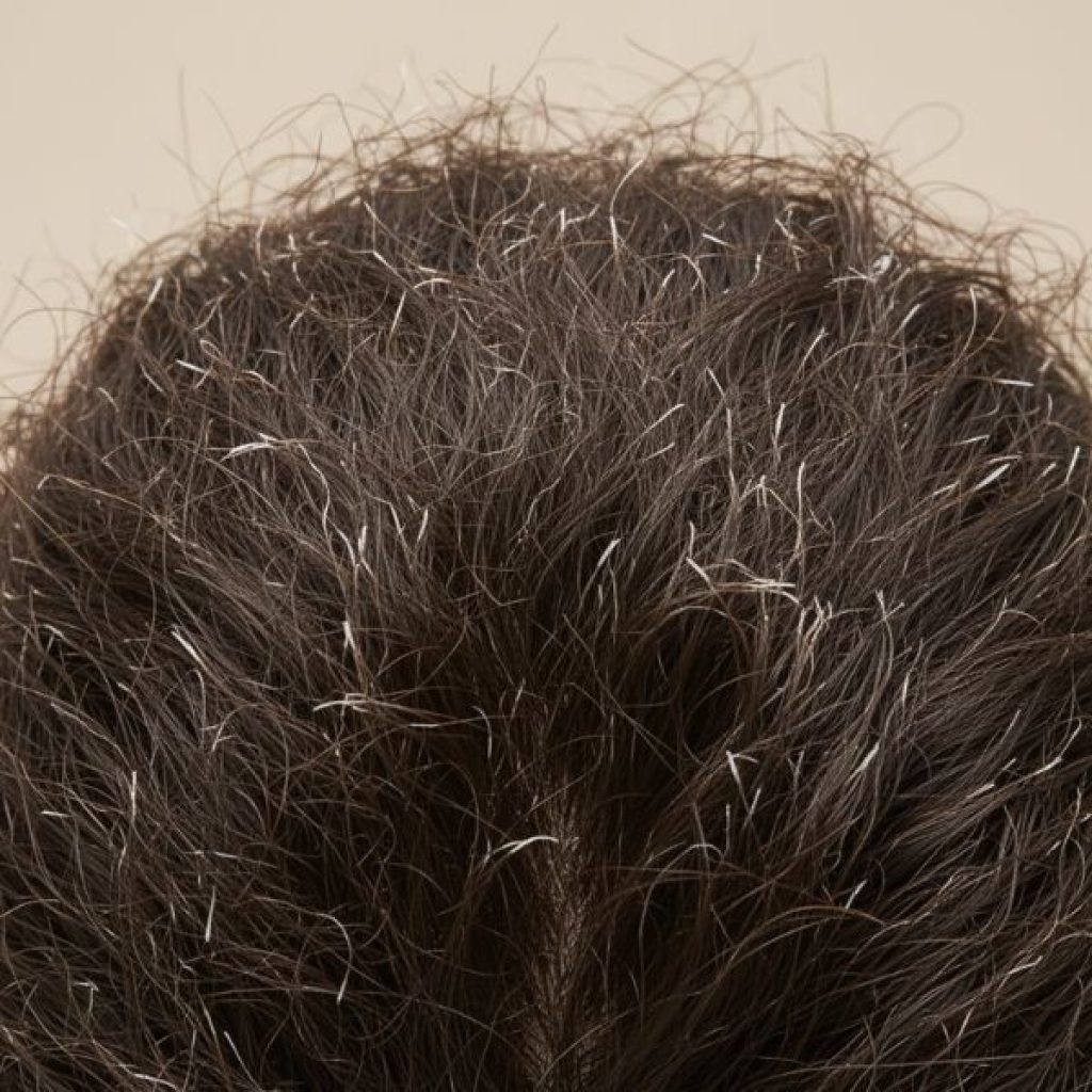 Frizz & Breakage